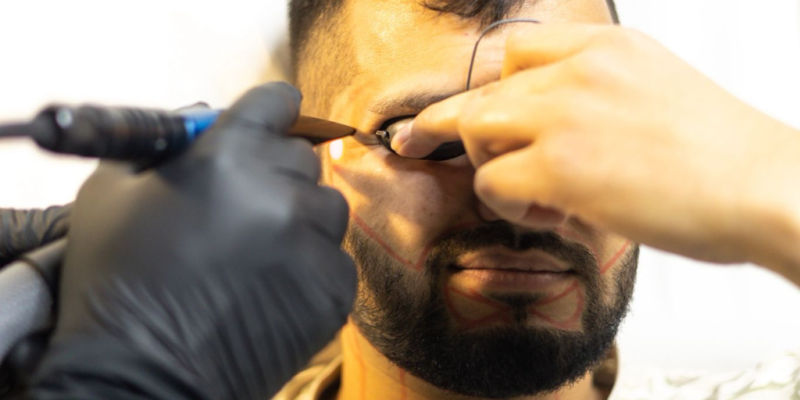 Jawline & Cheek Shaping_